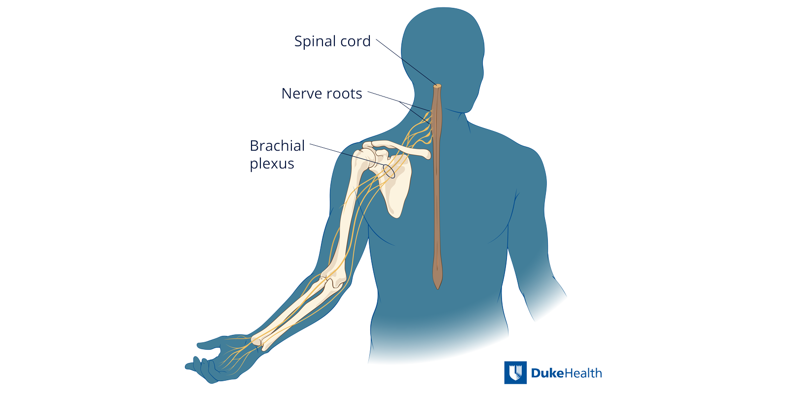 A diagram of the brachial plexus