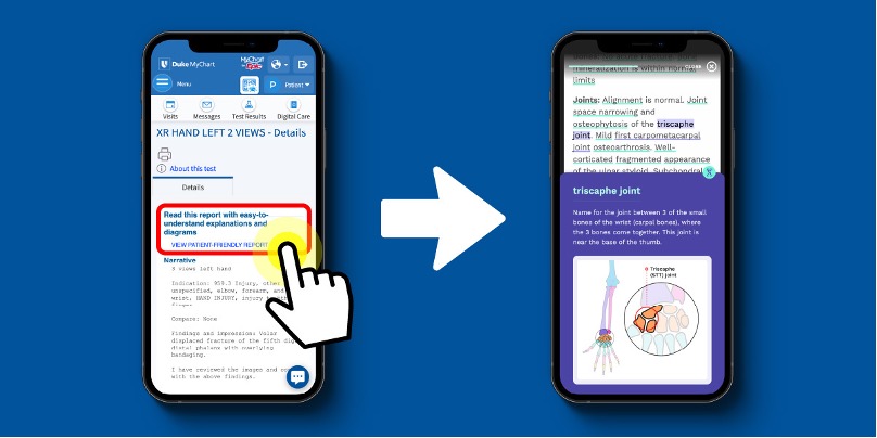 Illustration shows how to read imaging results from Duke yChart on phone