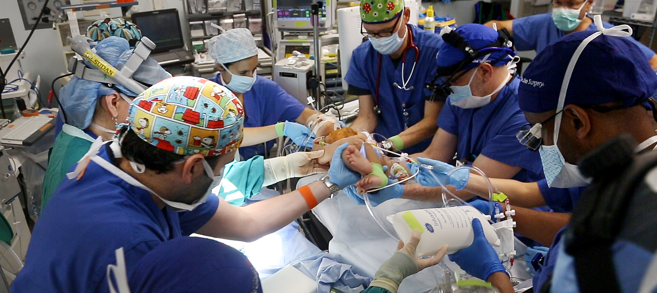 Duke surgeons and nurses lift and clean 8-month-old conjoined twins before surgery to separate them at Duke University Hospital in Durham on Thursday, June 18, 2015.