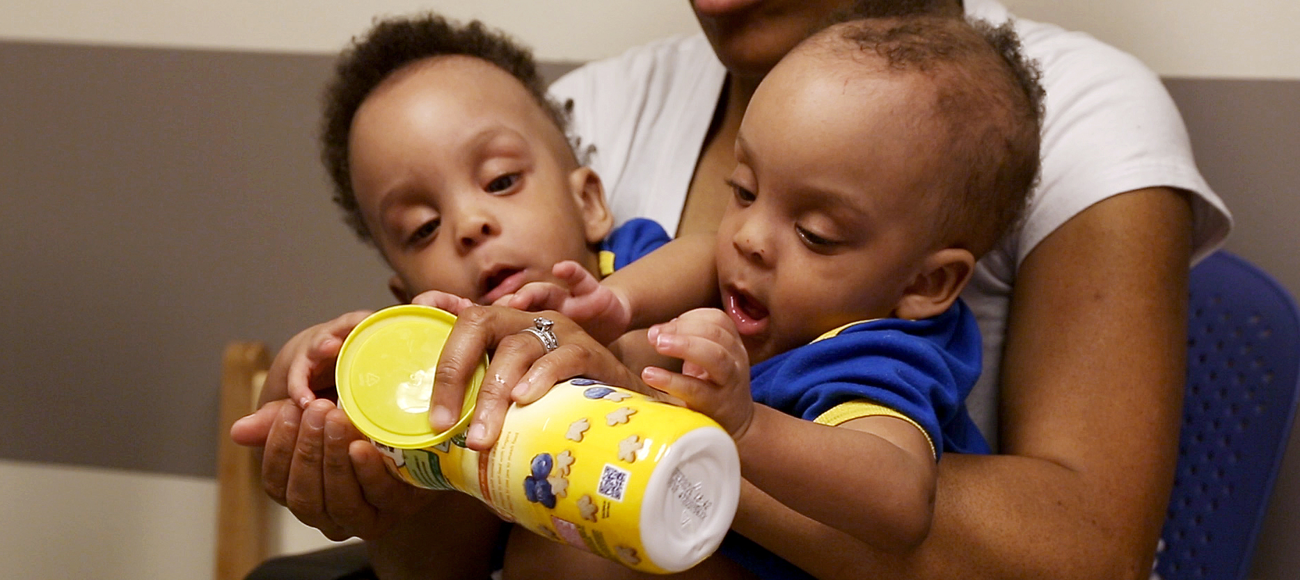 The twins sit on their aunt's lap the day before surgery.