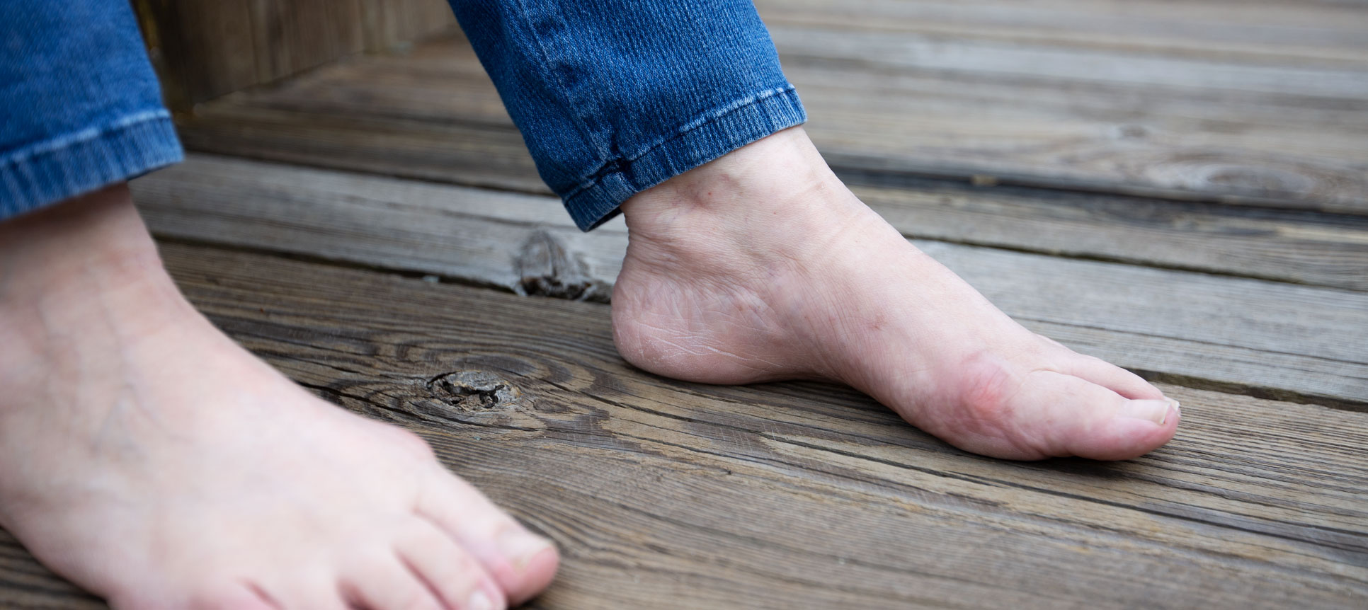 Kim Aiken's left foot with barely visible scar