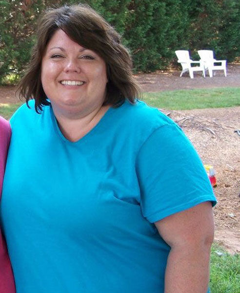 Michelle Taylor, in 2011 before her weight loss surgery