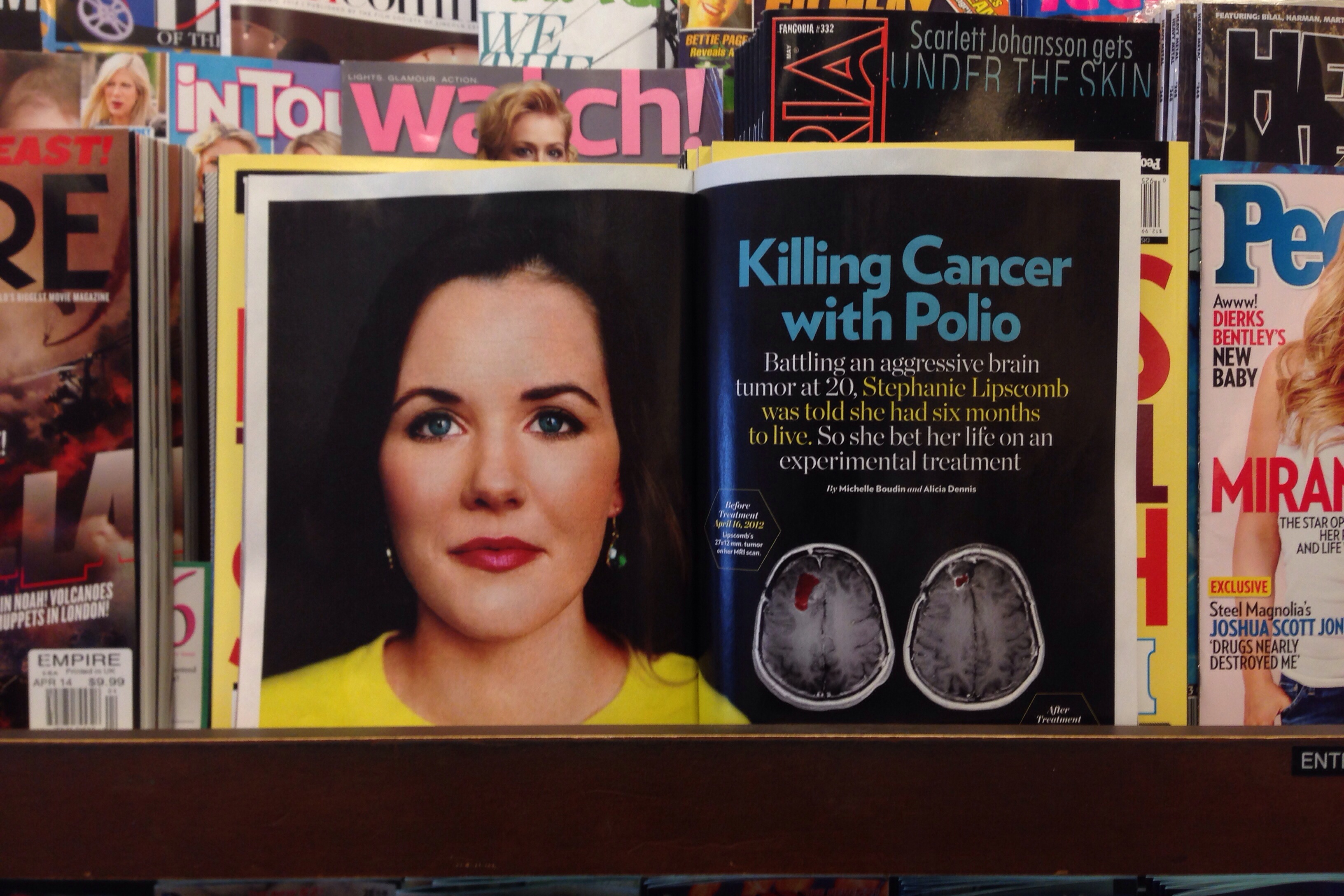 People magazine features Duke brain cancer research