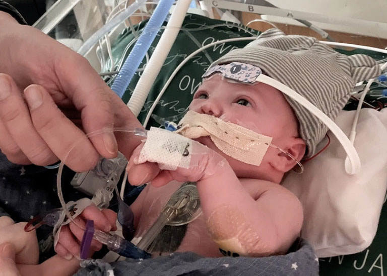 A baby hooked up to several devices is checked on
