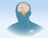 A DBS is shown in an illustration of a patient's brain and chest