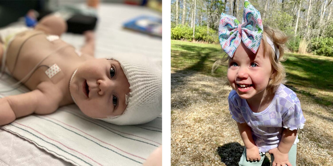 Left: Lily Twiddy during a hospital stay in 2021. Right: Lily smiles outside her home in Fayetteville, NC in 2023.