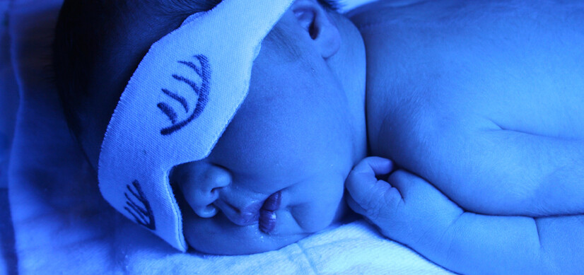 Bayi yang alami masalah jaundis perlu dijemur atau blue-ray.