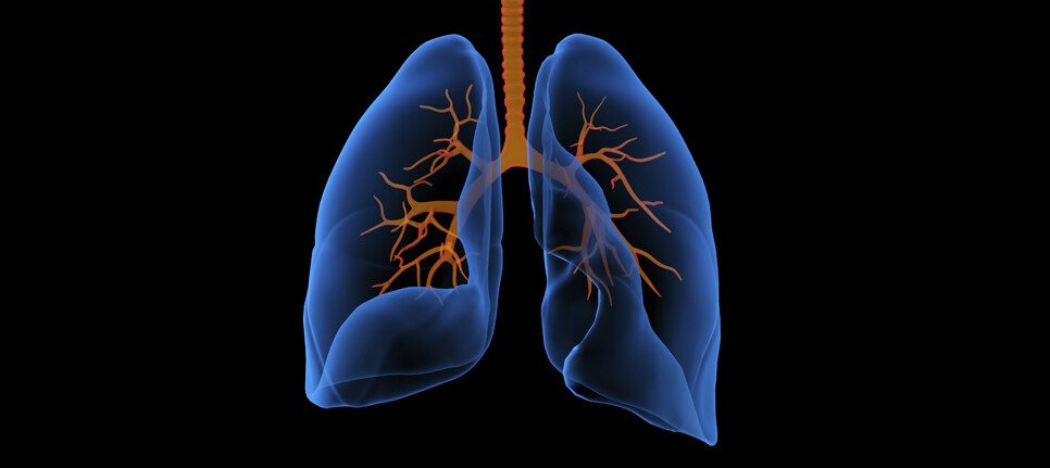 Duke uses new test to help diagnose lung cancer