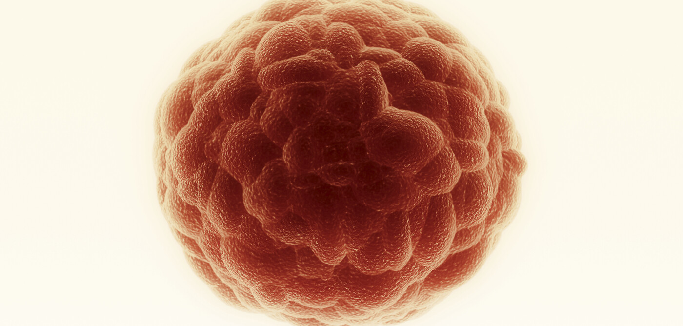 sentinel node biopsy benefits for endometrial cancer when diagnosed early.