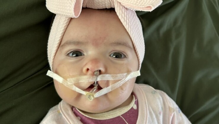 Zoey wearing her NAM device.