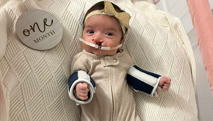 Zoey at one month old wearing the NAM device