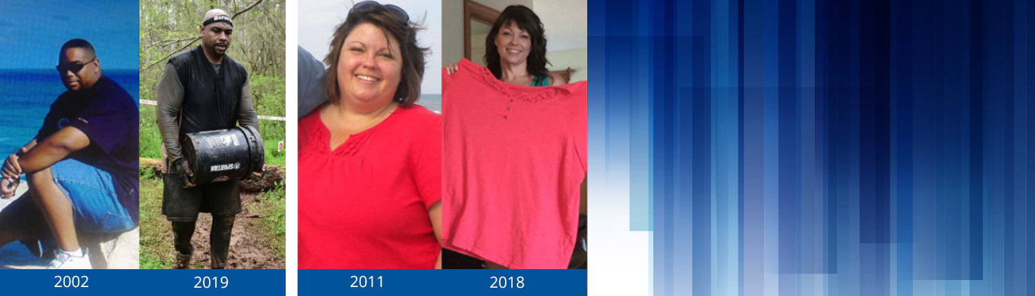 Weight Loss Surgery Before And After Photos Before And After Photos Duke Health